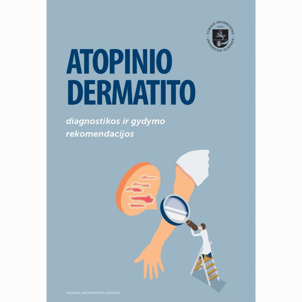 Atopinio dermatito diagnostikos ir gydymo rekomendacijos